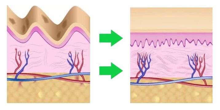 Intenskin aligns the skin