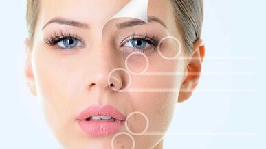 Face rejuvenation