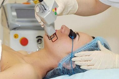 types of facial skin rejuvenation with laser